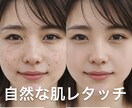 自然な肌レタッチ・ニキビや肌荒れを修正ます 満足いただけるまで無料で対応いたします イメージ2