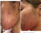 お肌の悩みがある方成分の見極め方教えます 有害な成分やその影響を教えます イメージ1