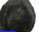 薄毛がグングン改善するとっておきの技法を教えます 頭頂部への気になる目線よ サヨウナラ！ イメージ5