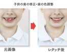 現役webデザイナーが写真加工やレタッチを致します 肌修正や色変更などを得意としております。歯の修正も可能です！ イメージ2
