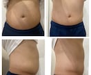 １か月間！優しい食事指導でダイエットサポートします 安心感のある声かけで凹みやすい人でも大丈夫！ イメージ6