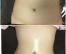 痩せたい人必見!!痩せさせます 痩せる痩せる痩せる!!やせまくり!! イメージ3