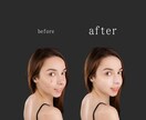 加工してないように見える自然な加工をします NALGaE photoはニキビ一つ一つ丁寧に消します。 イメージ1