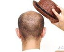 自信あり！発毛運UP祈祷＆自然な育毛法を教えます 潜在意識のブロックを中和する「プレミアム祈祷スペシャル」付き イメージ5