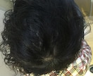 男性お悩みのAGAを経験を元に格安でお伝えします AGAやハゲで悩んでた僕の体験を元に薄毛対策を教えます。 イメージ2