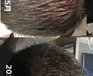 Amazon書籍で販売中の薄毛解消ノウハウあります 皮膚科と医薬品やサプリの輸入経験に基づく髪の毛の砂漠化改善法 イメージ3