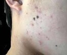 肌のお悩みの相談乗ります 肌荒れ、乾燥肌、毛穴がきになる方へ イメージ2