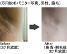 いいねで開始！脱毛器、当て方も含めレクチャーします 機器の入手方法から、実際に使用しながら使用法のレクチャーまで イメージ1