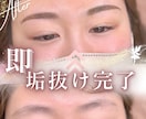 アートメイク看護師が普段の眉の運用アドバイスします 普段の眉の左右差のお悩み、運用に悩んでる方におすすめ！ イメージ2