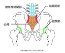 湿布なしで痛みを解消！腰痛改善の講座を行います 誰も教えてくれなかった腰痛の原因　それは「仙骨」の歪みです イメージ3