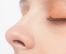 いちご鼻、鼻の毛穴の黒ずみを治す方法教えます 鼻の毛穴を綺麗にしたいあなたへ イメージ1