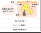 思春期ニキビの改善方法を提案します 中学生、高校生真っ赤な思春期ニキビにお困りの方 イメージ1