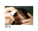 メンズヘアカウンセラー  薄毛のお悩み解消します ☆スタート価格500円☆AGA治療、植毛、育毛、ウィッグ イメージ4