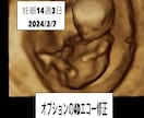 専門医が赤ちゃんの性別予測とエコーの解説をします ベビーナブ対応！11週以降のエコーであれば判定します。 イメージ4