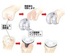整形外科専門医が医療イラストを描きます 論文用シェーマや患者説明用イラストなどに！ イメージ3