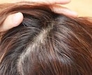 育毛は「頭皮」で決まる。見直すべき頭皮の事話します 抜け毛、薄毛の本当の話を発毛サロンの私の話を聞いてください イメージ1
