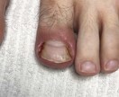 サロン向けです⭐️病的トラブルへの対策を伝授します お客様やあなたのリスクヘッジの為にレベルアップしませんか❓ イメージ9