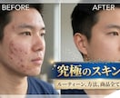 綺麗な肌への究極のスキンケア教えます！ます 考え方を変えて、実行するだけ！ イメージ1