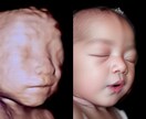 AIでエコー写真から赤ちゃんのお顔を予測します 未来の可愛いお顔を先取り、ワクワクが止まらない イメージ2