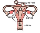 医療関係のイラストを作成します 講習会や教科書、テキストやポスターなどに使用頂けます。 イメージ2