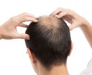 育毛・発毛・抜け毛の原因・一般論をお伝えします これであなたも髪の悩み無し！〜髪の毛の一般論を知ろう〜 イメージ1