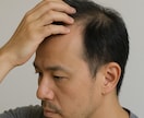 男性専門/薄毛や育毛のご相談をうけます 理容師、美容師歴、AGA勤務経験を活かしたオーダーメイド相談 イメージ2