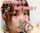 リストカット、OD、依存症、改善の手助け致します 認知行動療法、声掛け、悩み相談、精神保健福祉士が支えます イメージ4