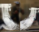 足首の捻挫を頻繁に繰り返す強化プログラム作成します 何度も繰り返し捻挫する問題には必ず原因があり〇〇を強化する事 イメージ9