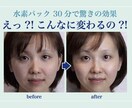 お肌のお悩みを解決します 30分後は5年前の生まれたての素肌に イメージ3