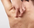 あなたのつらい強烈な肌トラブルを根本から改善します 全身に血液とリンパの流れを良くし強烈な肌トラブルを解消します イメージ1