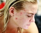 肌のお悩みの相談乗ります 肌荒れ、乾燥肌、毛穴がきになる方へ イメージ1