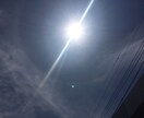 お悩み相談します 人には相談しにくい事でも介護士やってますので是非是非 イメージ2
