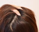 天然のアレを使うだけで育毛効果があります 薄毛やまつ毛にハリが無い方必見です！ イメージ2
