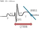 心電図検定1級が心電図検定試験に向け相談に応じます 臨床・試験対策・症例読影まで幅広く対応！ イメージ2