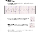 心電図検定1級が心電図検定試験に向け相談に応じます 臨床・試験対策・症例読影まで幅広く対応！ イメージ5