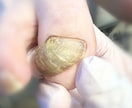 この爪どうやって切ったらいいの？その疑問に答えます 爪のトラブルお任せください！！ イメージ1
