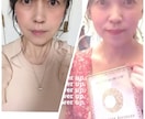 楽しくお喋りしながらお顔も気分もアゲちゃいます たるみ世代必見！！リフトアップ、小顔、美肌が叶う遠隔エステ♡ イメージ1