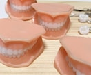 歯科業界の方にお勧めでございます 歯科！歯入れ歯ストラップ、ボールペン イメージ2