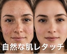 自然な肌レタッチ・ニキビや肌荒れを修正ます 満足いただけるまで無料で対応いたします イメージ5