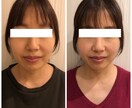顔の筋膜リリースで顔が痩せます 小顔ソムリエ監修【10名様限定価格】 イメージ1