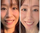 老け見え対策を表情筋レッスンをします たるみ・ほうれい線を自己流から卒業 イメージ1