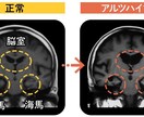 健康・認知症予防運動,プランを提供します 人生100年時代を健康に生きるために。 イメージ2