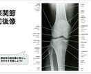 膝関節についての資料を提供します トレーナーやセラピスト必見！膝関節のあれこれが分かります！ イメージ3
