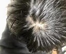 血流改善で頭頂部の薄毛を改善させます 内服薬などの副作用が不安な方必見！ イメージ1
