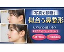 写真で診断！あなたに似合う鼻整形提案します 現役カウンセラーが自然なデザインができる施術提案します！ イメージ1