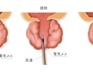 分かりやく見やすい！医療・解剖イラストを作成します 医療系イラスト実績あり！WEB・資料・論文作成をサポート！ イメージ5