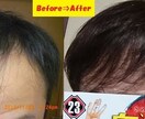 薄毛を克服した体験談を提供致します 薄毛は改善できます！私はハゲの悩みから解放されました！ イメージ1