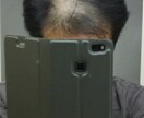 抜け毛減!薄毛ハゲにならない髪の洗い方を伝授します 毎日シャンプーしなくてもいい頭皮に優しい洗い方 イメージ2