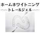 歯の☆ホワイトニング☆についてお答えします セルフ/オフィス/ホームの違い/施術内容/相談/笑顔/モテ イメージ6