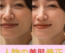 Photoshopで美肌加工いたします 【高クオリティ】レタッチ専門のプロが修正、レタッチいたします イメージ2